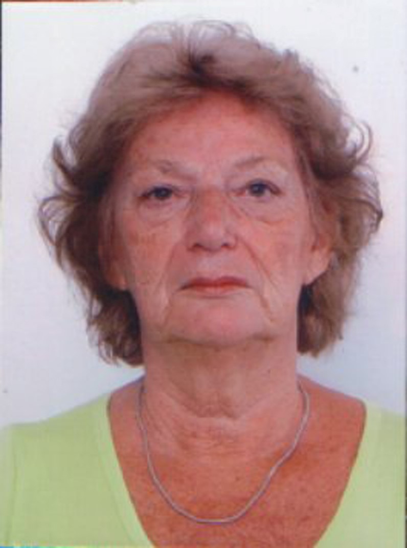 Слика члана